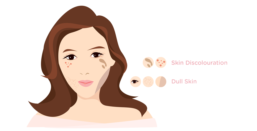 SKIN DISCOLOURATION